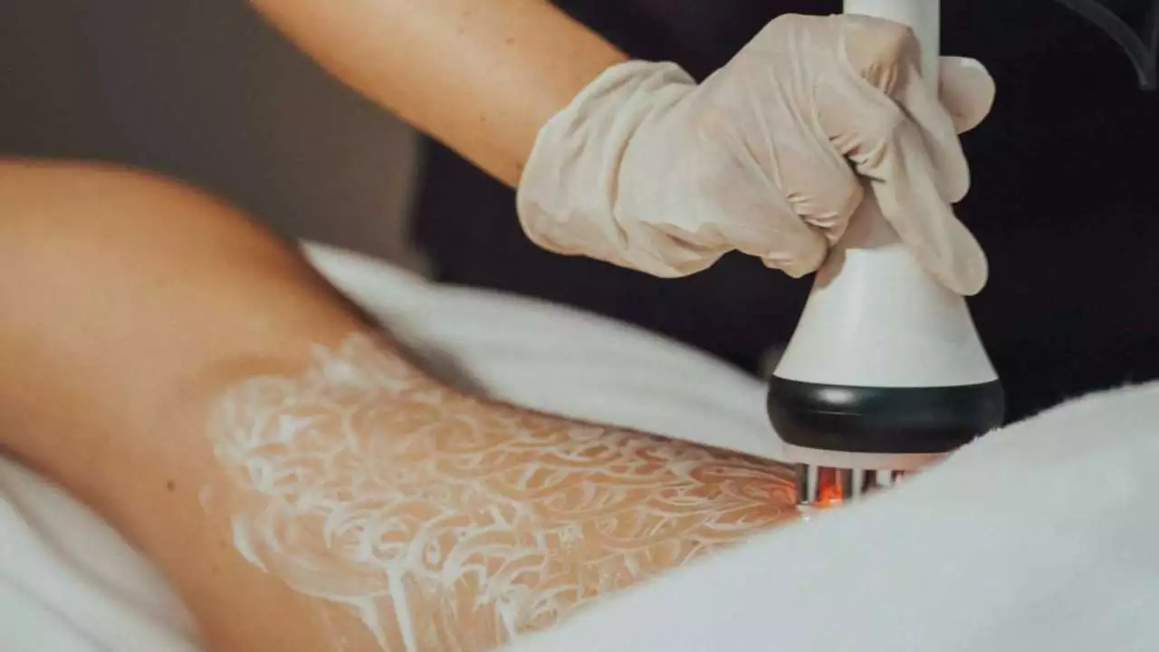 IMG 20221205 WA0003 - Beauty Treatments